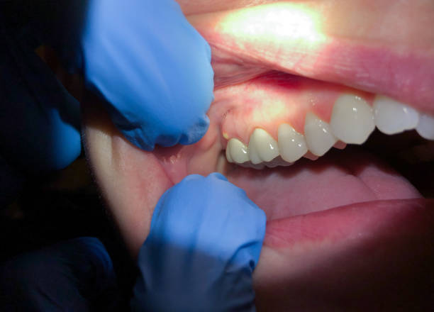 Best Emergency Dental Care for Trauma or Injury in Manistique, MI