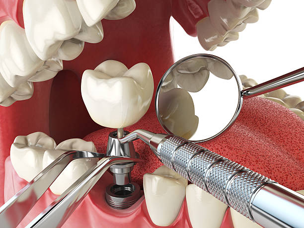 Best Emergency Dental Surgery in Manistique, MI