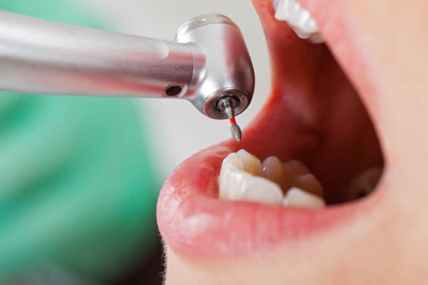 Best Weekend Emergency Dentist in Manistique, MI